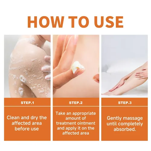Crema Para El Cuidado De La Psoriasis Con Extracto De Miel D