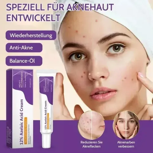 Crema Calmante Anti-acné: Ideal For Piel Sensible ^.^