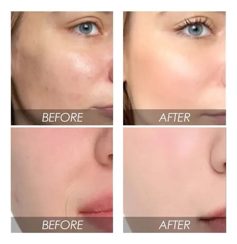 Ai . Loción Hidratante Facial Blanqueadora De Sandía 30 Ml .