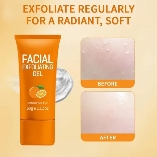 Gel Exfoliante Facial Naranja 60 G Puntos Negros Todo Tipo De Piel Día/noche