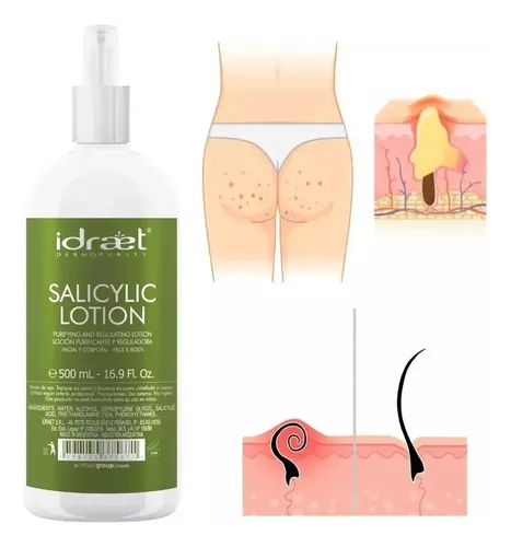 Salicylic Lotion Idraet X 500ml. Facial Y Corporal. Acné.
