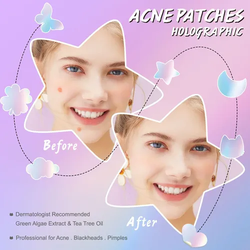 84 Parches Laser Stars For Grains Para Acné &rp