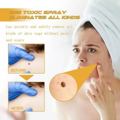 A 6pcs Tag Recede Bee,tag Recede Bee Spray For Mujeres Y