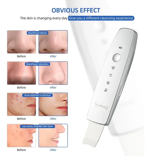 6 Depuradores, 1 Iolephoton Em Ultrasonic Skin En Qg