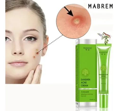 Crema Eficaz En Gel Para El Acné, Eliminación De Manchas A B