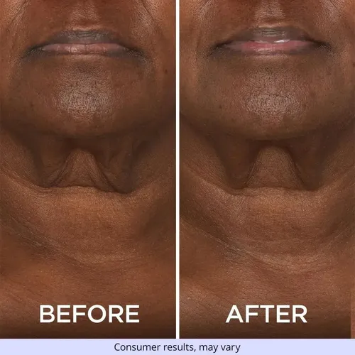 .sa Crema Reafirmante De Cuello Gopure Sj 2566031842005 .hg