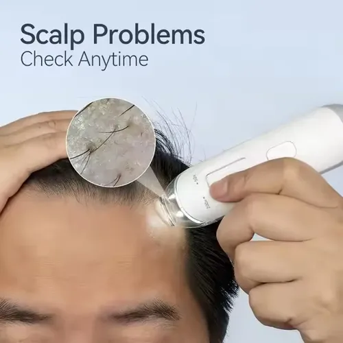 Máquina De Dermatoscopio, Analizador De Cuero Cabelludo Hd S
