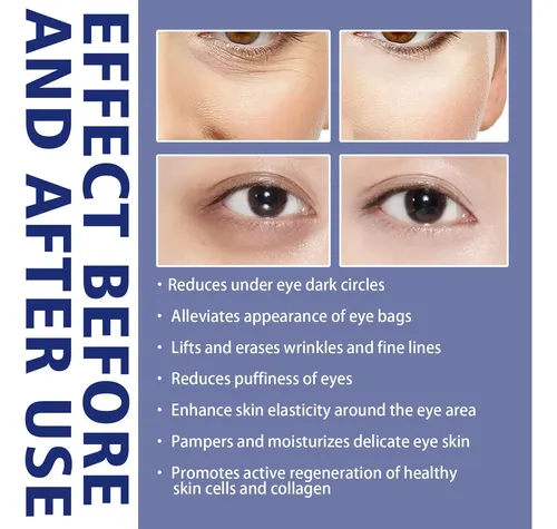 2 Unidades Crema Para Ojos Dos Minutos Para Quitar Bolsas