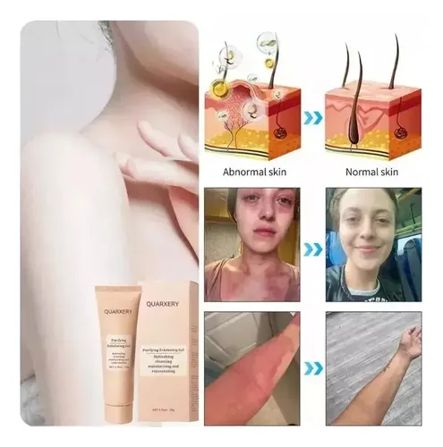 Quarxeri Purificante Exfoliante, Gel Exfoliante Avanzado Vs