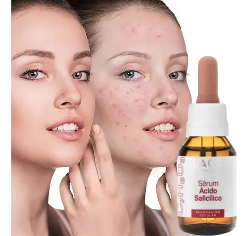 Serum Ácido Salicílico 2% Piel Grasa Reduce Poros Laca Momento De Aplicación Noche