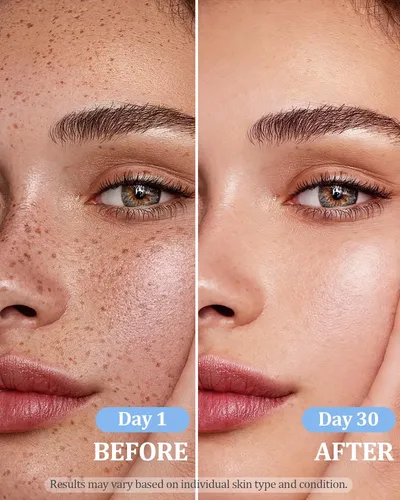 Crema Eliminadora De Manchas Oscuras Gajuanr Para Rostro Y C