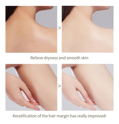 Gel Exfoliante Limpiador Facial Naranja Hombres Y Mujeres