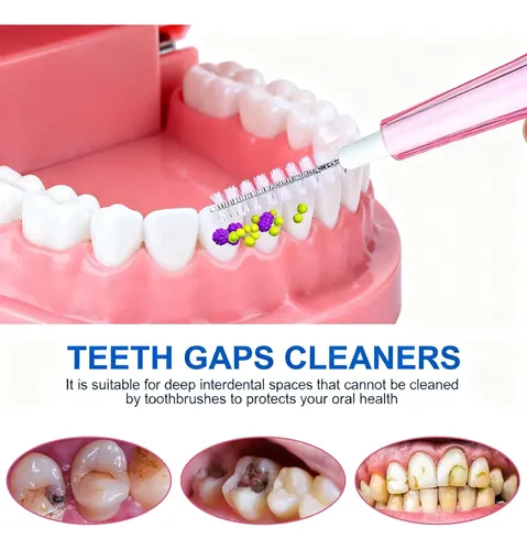 Cepillo De Hilo Dental De 0,5 Mm Para Dientes Y Encías, 30 U