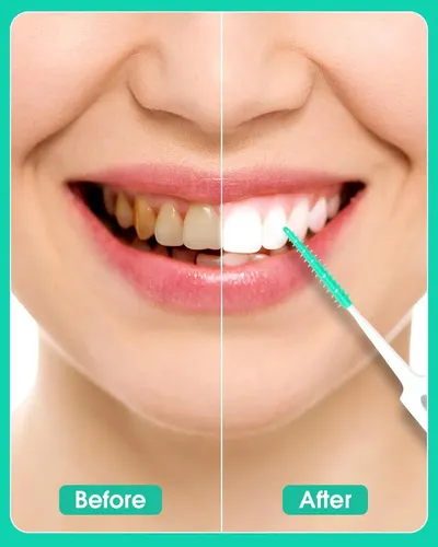 220 Palillos Dentales Verde Con Cepillo Interdental