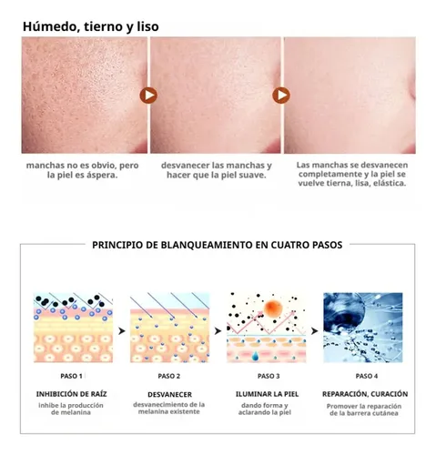 Crema Blanqueadora Para Manchas Oscuras, Antipecas,