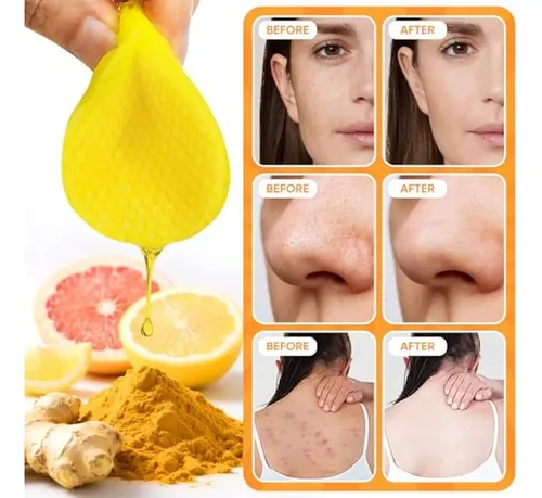 Almohadillas Limpiadoras De Cúrcuma, 50 Unidades, Barra De J
