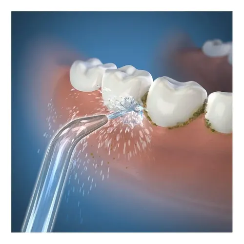 Boquillas Clásicas De Chorro Waterpik Para Limpieza Dental
