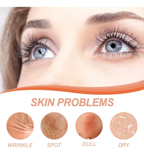 Crema Reafirmante Facial Hoygi Para Arrugas E Iluminar