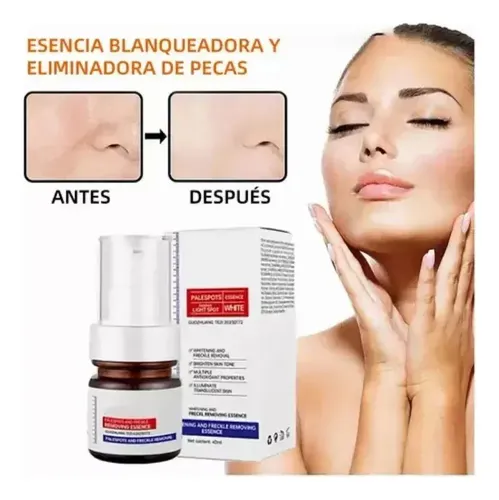 Whitening Y Freckle Eliminar La Esencia,aobenz