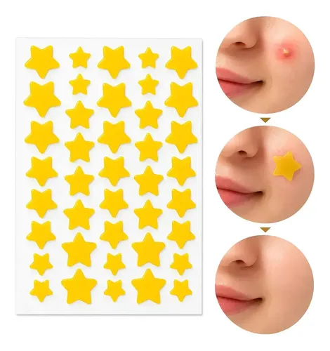 Parche Para Granos Elimina Acne Forma De Estrella 40unidades