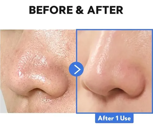 Bálsamo Limpiador Hidro Boost Enzimático Tirtir 9g