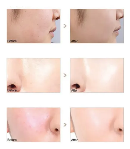 Phoera Primer Facial Hidratante Mate 18 Ml