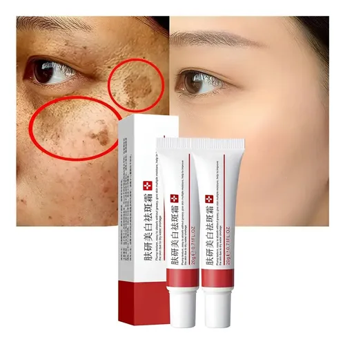 +crema Para Manchas Oscuras En La Cara, Cremas Para Quitar /