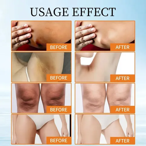 Special Offer T; Crema Correctora De Manchas Oscuras ..