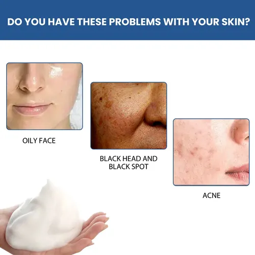 Pmlimpiador Facial Hidratante Suave: Gel De Limpieza Facial@