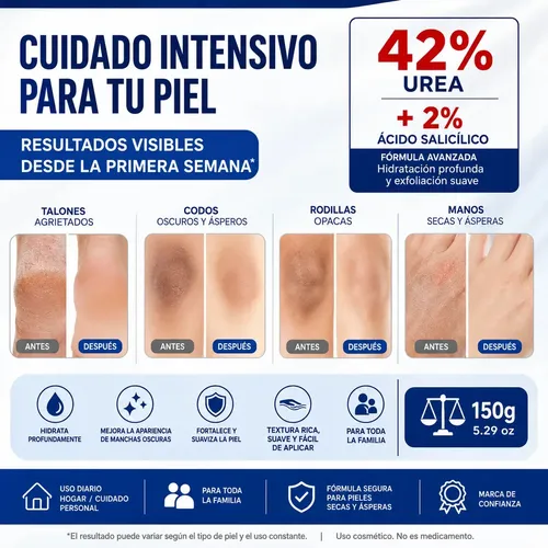 Exfolia Hidrata Crema De Urea Pies Talones Agrietados 2x150g