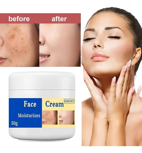 Crema Iluminadora Para Manchas Y Pigmentación