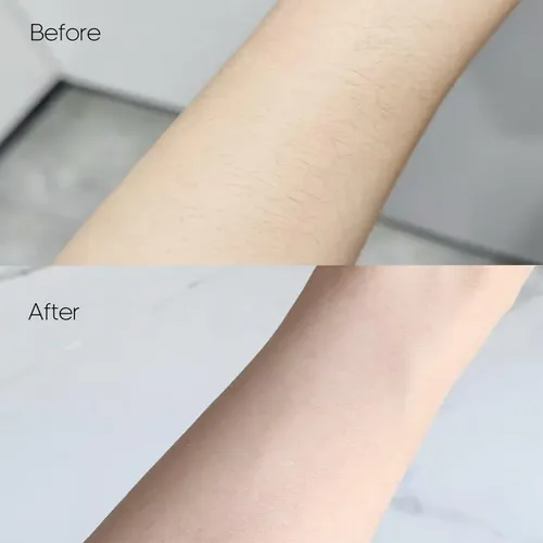 Maquinilla De Afeitar Eléctrica 6 En 1 Bikini Trimmer Pelcas