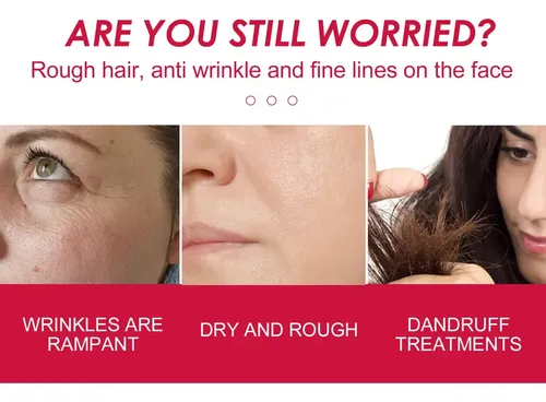 Aceite Facial Rosa Mosqueta Hidratante Repara Piel