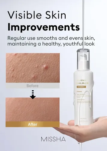 Sérum De Mucina De Caracol Missha Cell Renew, 3.38 Onzas Líq Todo Tipo De Piel