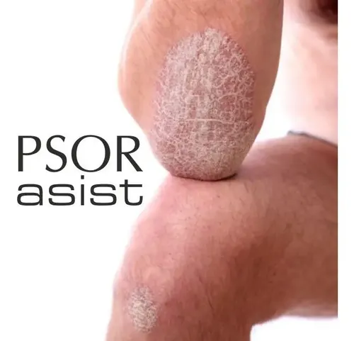 2 Cremas Psor Piel Escamada 250g + 1 Champu-gel Anticaspa Bine