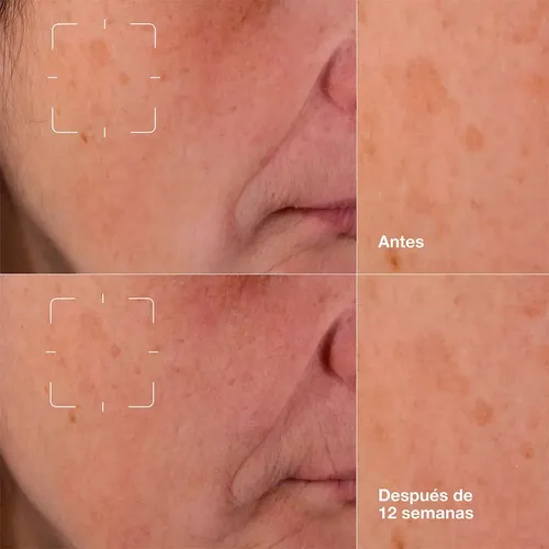 Serum Clinique Even Better Anti Manchas Con Vitamina C 30ml