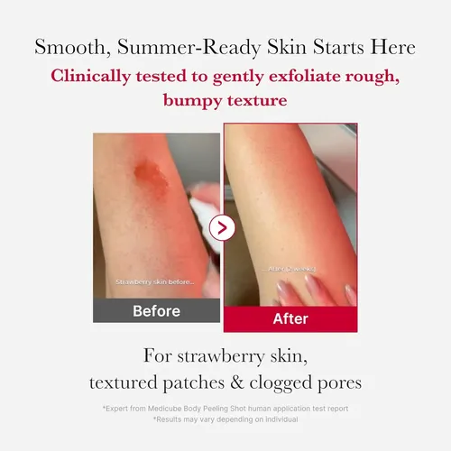 Medicube Red Body Peeling Shot. Spray Corporal Exfoliante.