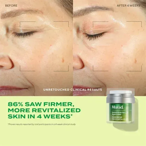 Murad Retinol Youth Renewal Night Cream 15 Ml