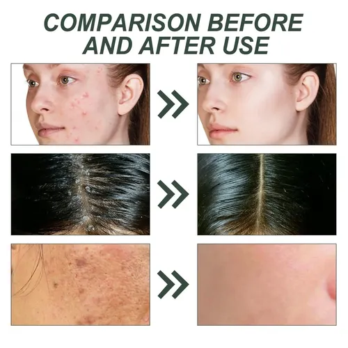 Aceite Masaje Romero 60ml Cuidado Corporal
