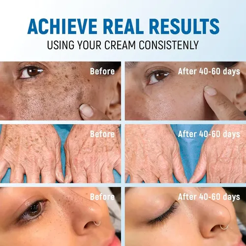 Crema Aclaradora De Manchas Oscuras Penebella 108g