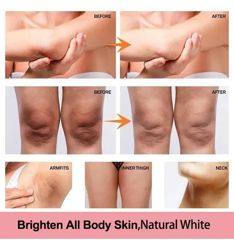 Crema Blanqueadora De Vitaminas Para Pieles Oscuras, .