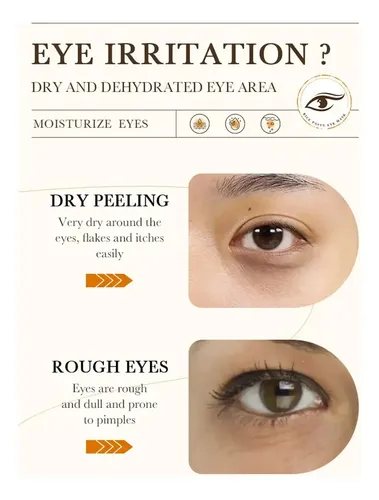 New 2026- Parche Hidratante For Ojos Con Puré De */rgh