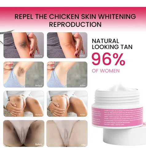 .a Crema Blanqueadora Íntima 30 G, Axilas, Rodillas Y Línea
