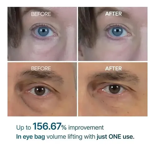 Aadr. Melaxin Crema Contorno De Ojos Bolsas Y Ojeras – .ss