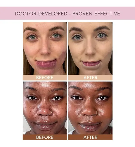 Doll 10 Tce Liquid Filter Cc Cream Vegano 30 Días