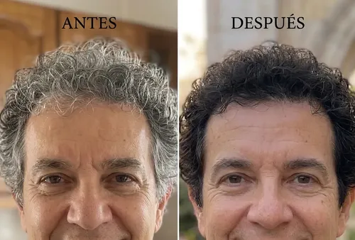 Shampoo Anti-canas Elimina Las Canas De Forma Natural