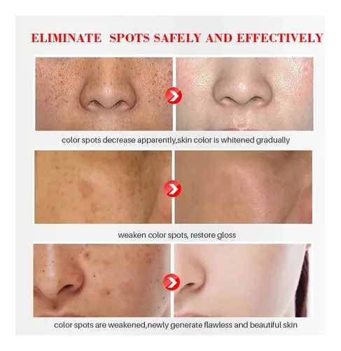 Crema Eliminadora De Manchas Oscuras Antienvejecimiento Para Día