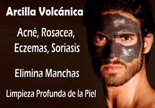 Arcilla Volcánica Calma Dolores Espalda Varices Piel Firme