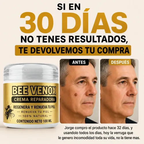 Tratamiento Verrugas Bee Venox Sin Dolor Ni Marcas 100ml 3×2