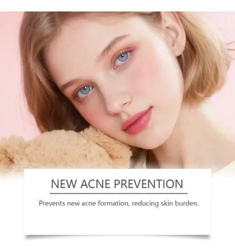 Crema Antiacné Con Ácido Azelaico De 30 G